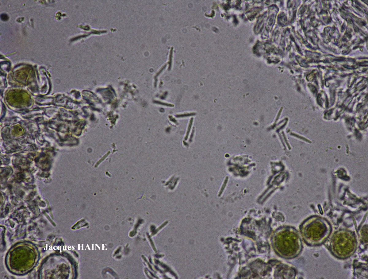 Protoparmelia montagnei chemo aquilina forme de régénérescence.